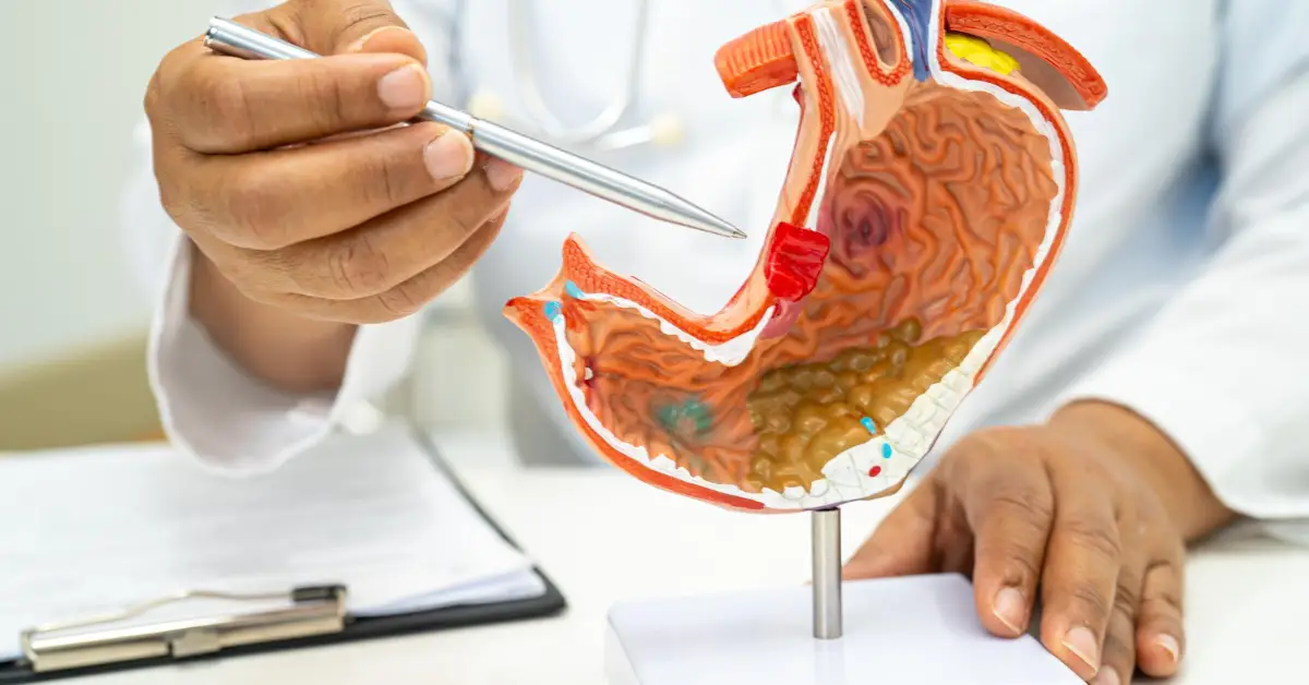 Bowel Resection & Anastomosis