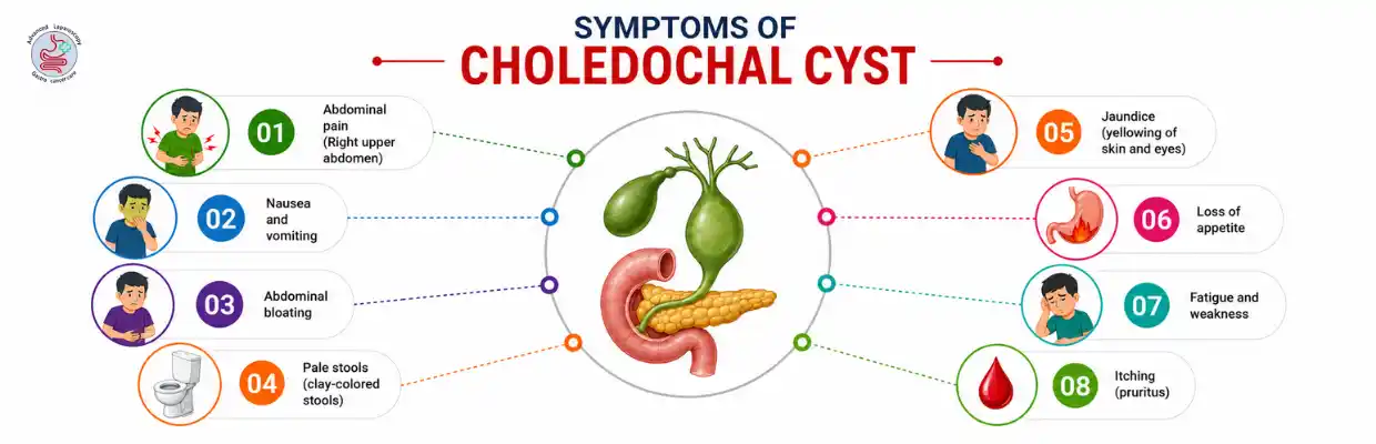 Choledochal Cyst Treatment in Chennai
