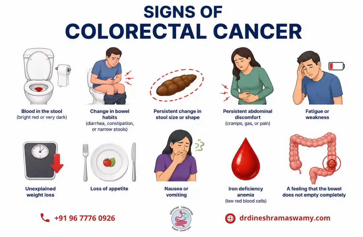 Colorectal Cancer Surgery in Chennai