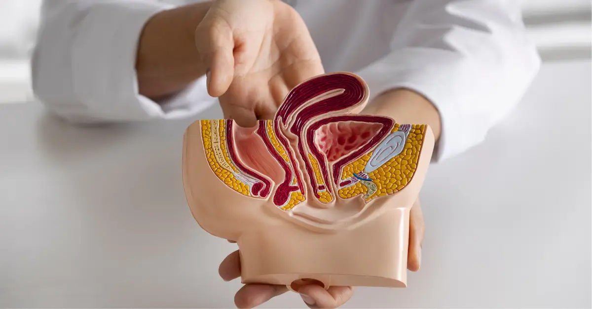 Fistulectomy in chennai