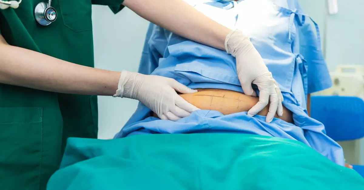 Hiatus Hernia Surgery in Chennai
