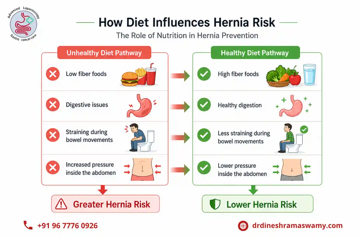 Inguinal Hernia Repair in chennai