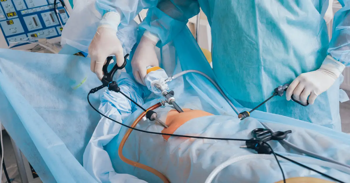 Laparoscopic Anti-Reflux Surgery in Chennai