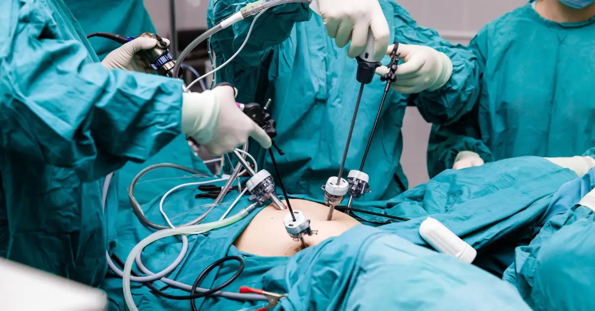 Laparoscopic Splenectomy