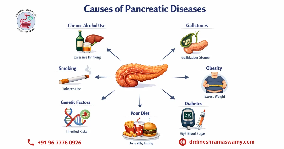 Pancreatic Surgery in Chennai