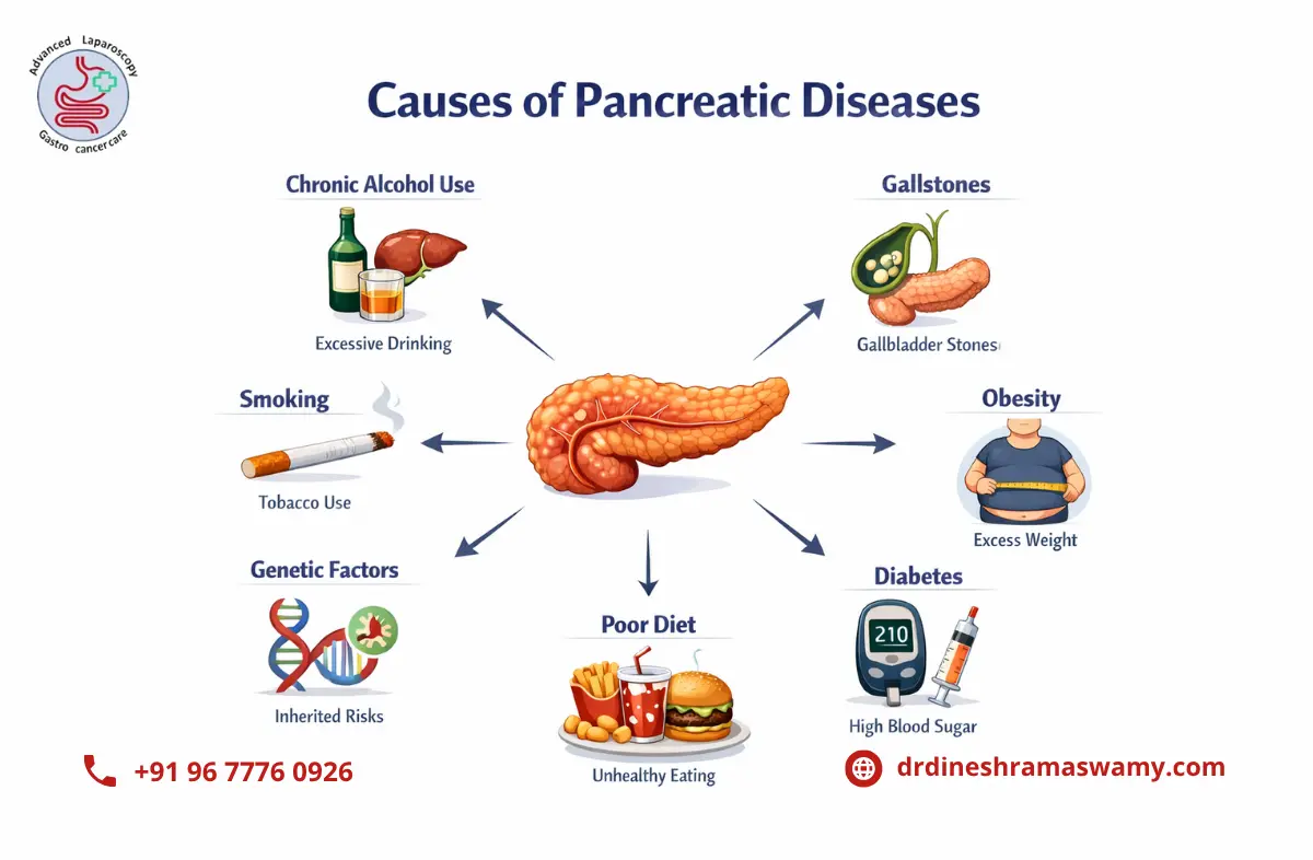Pancreatic Surgery in chennai
