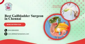Best Gallbladder Surgeon in Chennai