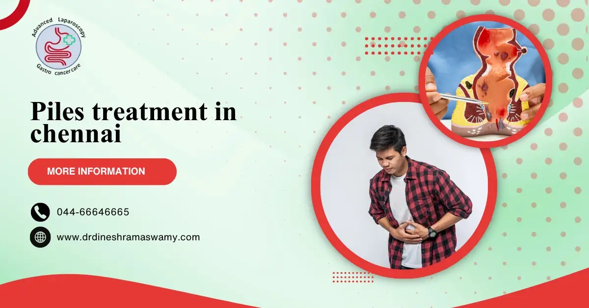 Piles treatment in chennai