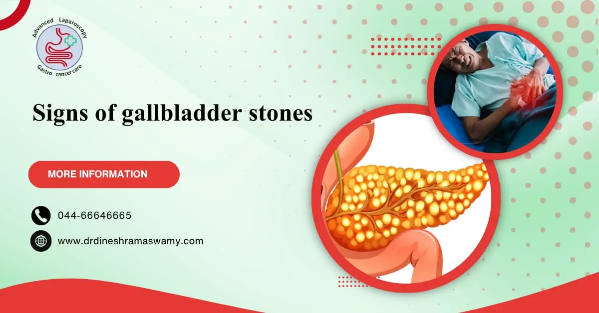 Signs of gallbladder stones