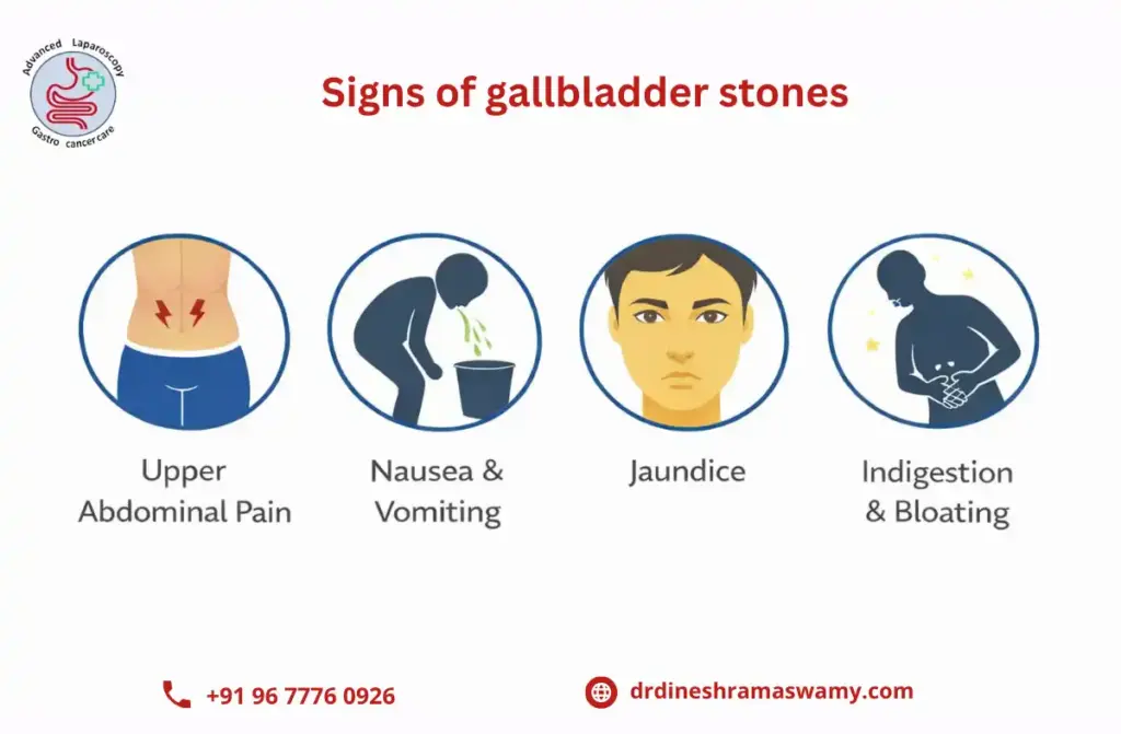 Signs of gallbladder stones