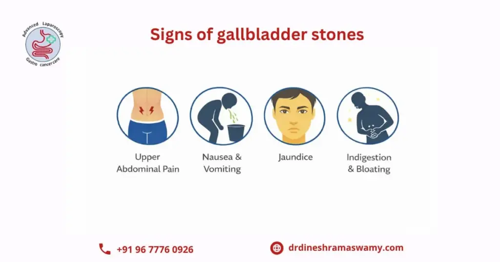 Signs of gallbladder stones