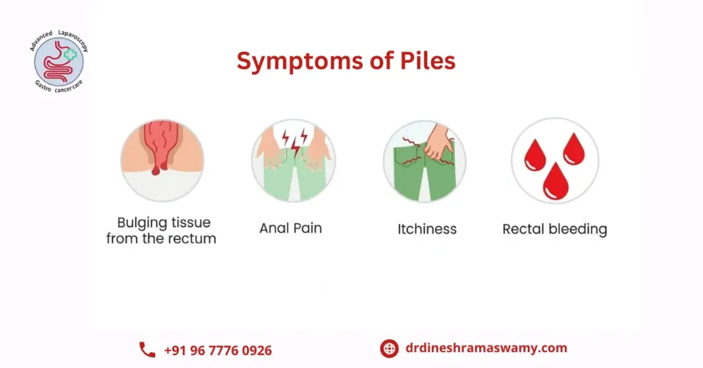 Piles treatment in chennai