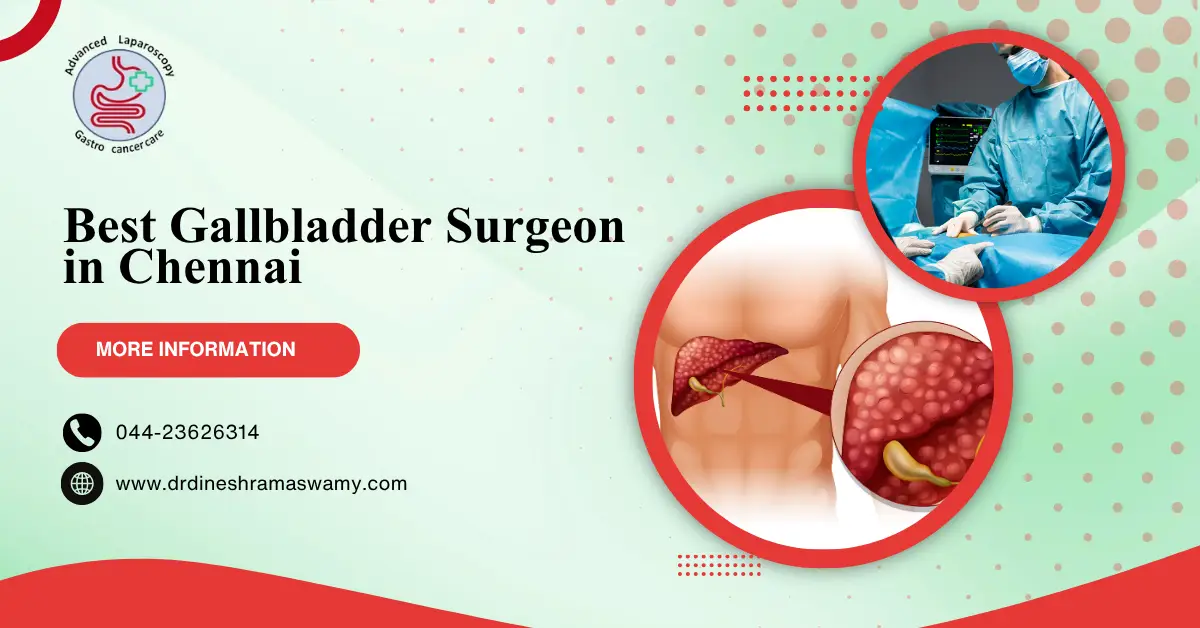 Best Gallbladder Surgeon in Chennai