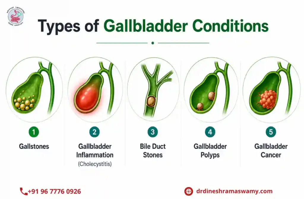 Best Gallbladder Surgeon in Chennai