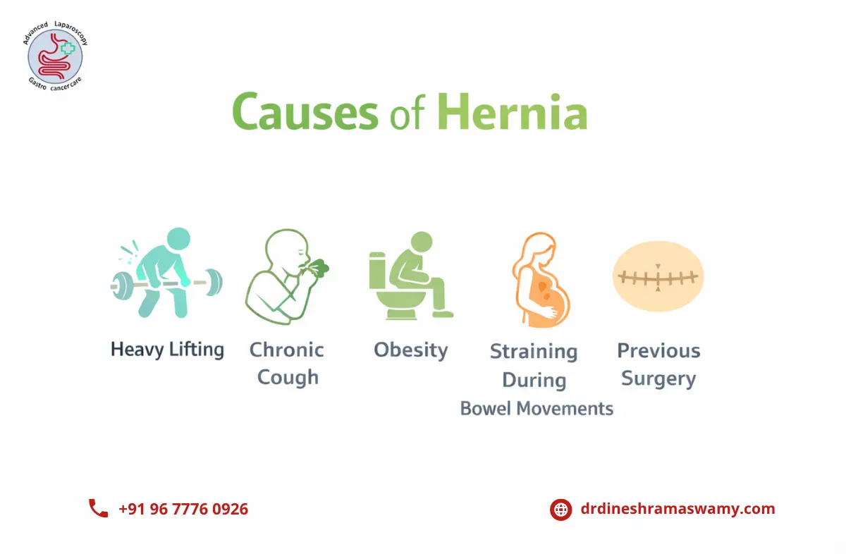Hernia repair