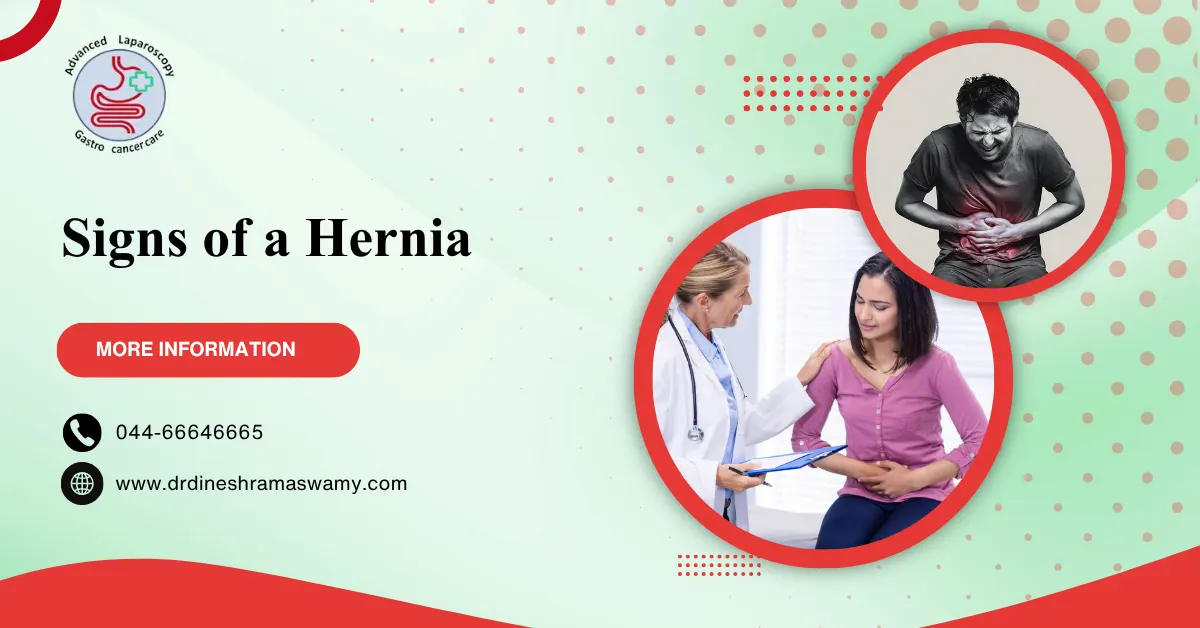Signs of a Hernia