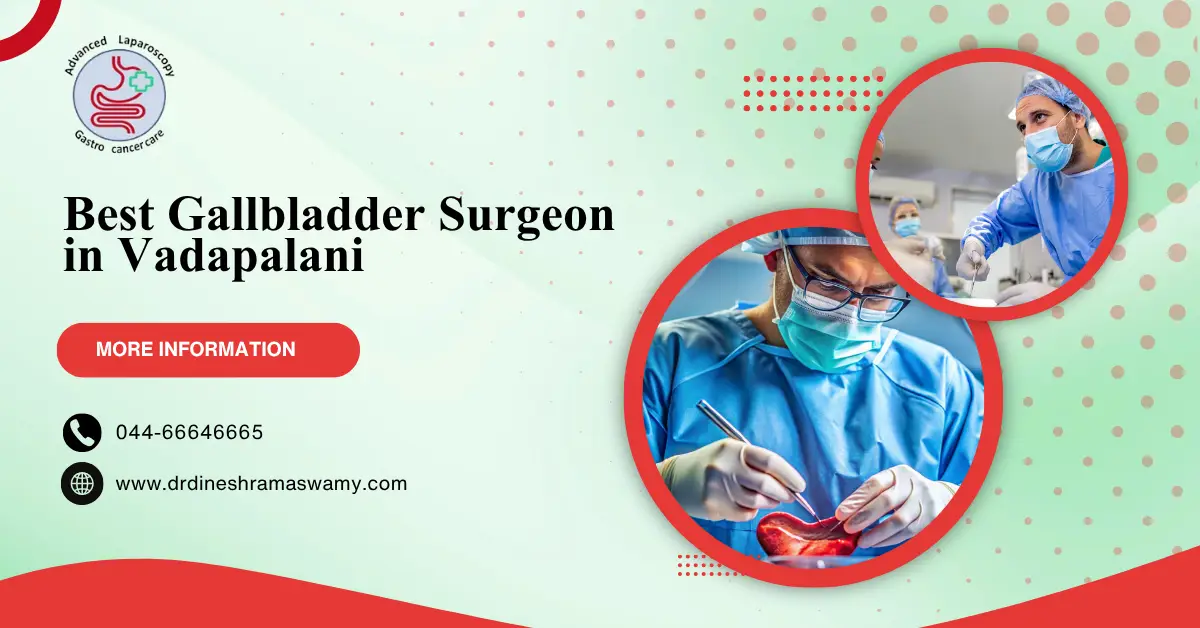 Best Gallbladder Surgeon in Vadapalani