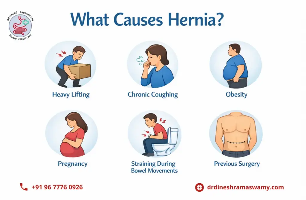 Signs of a Hernia