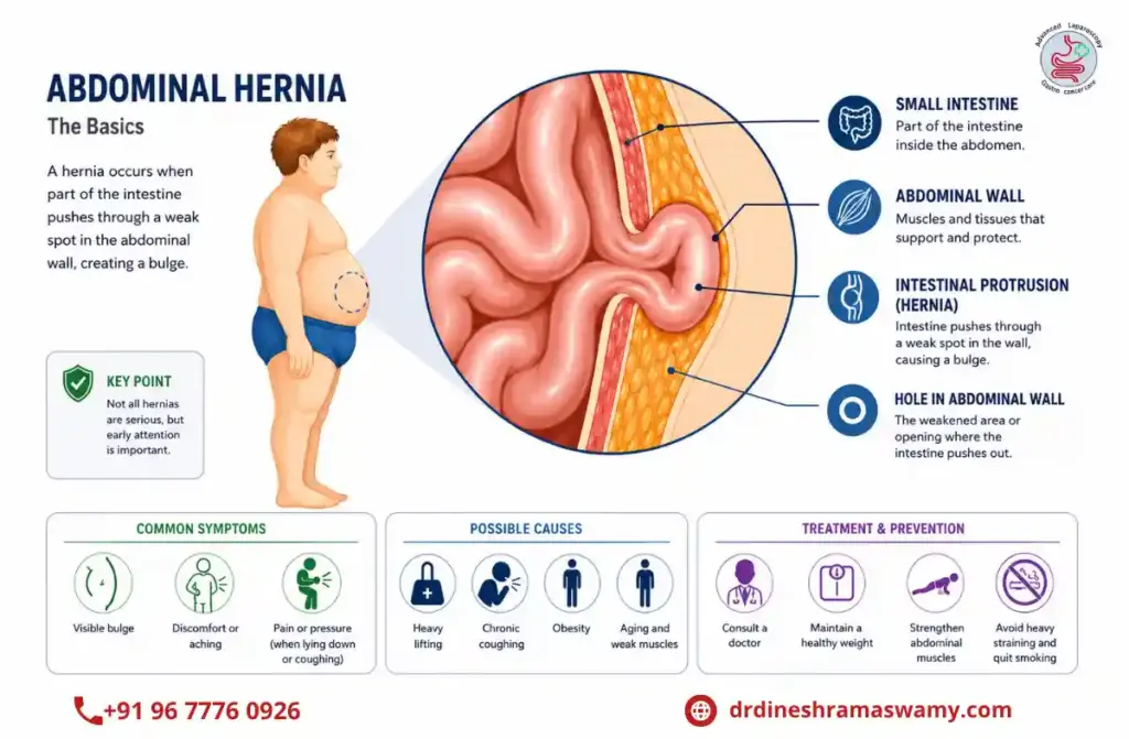 Best Hernia Surgeon in Chennai