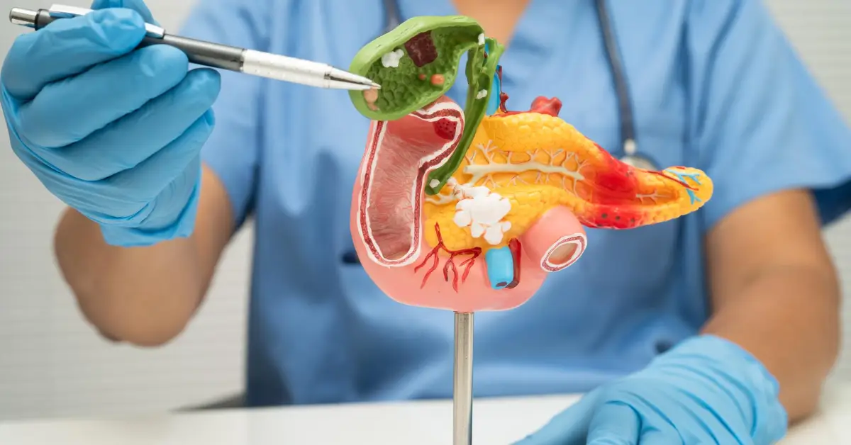 Bile-Duct-Surgery
