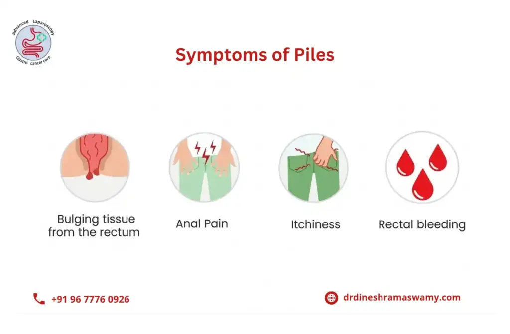 Symptoms of Piles