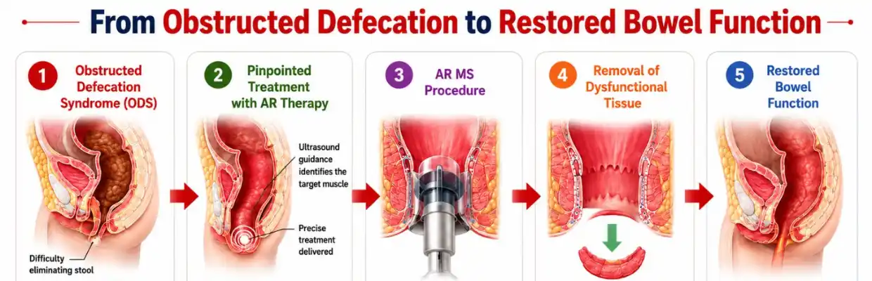 STARR Procedure