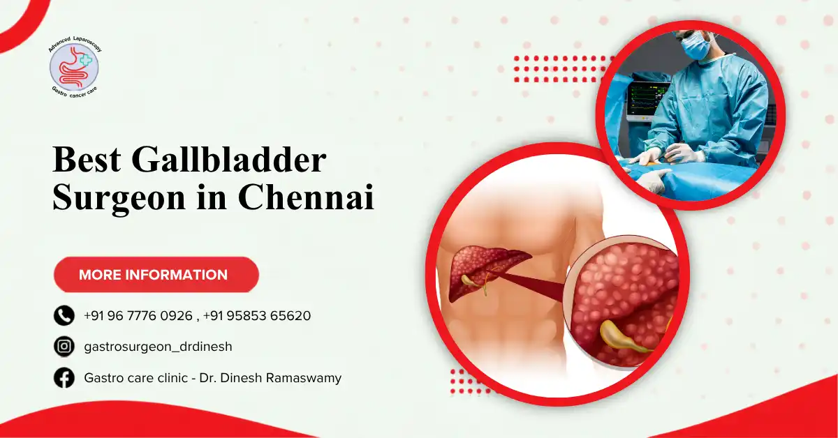 Gallbladder Surgeon in Chennai