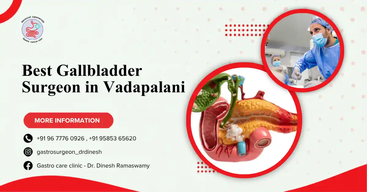 Best Gallbladder Surgeon in Vadapalani