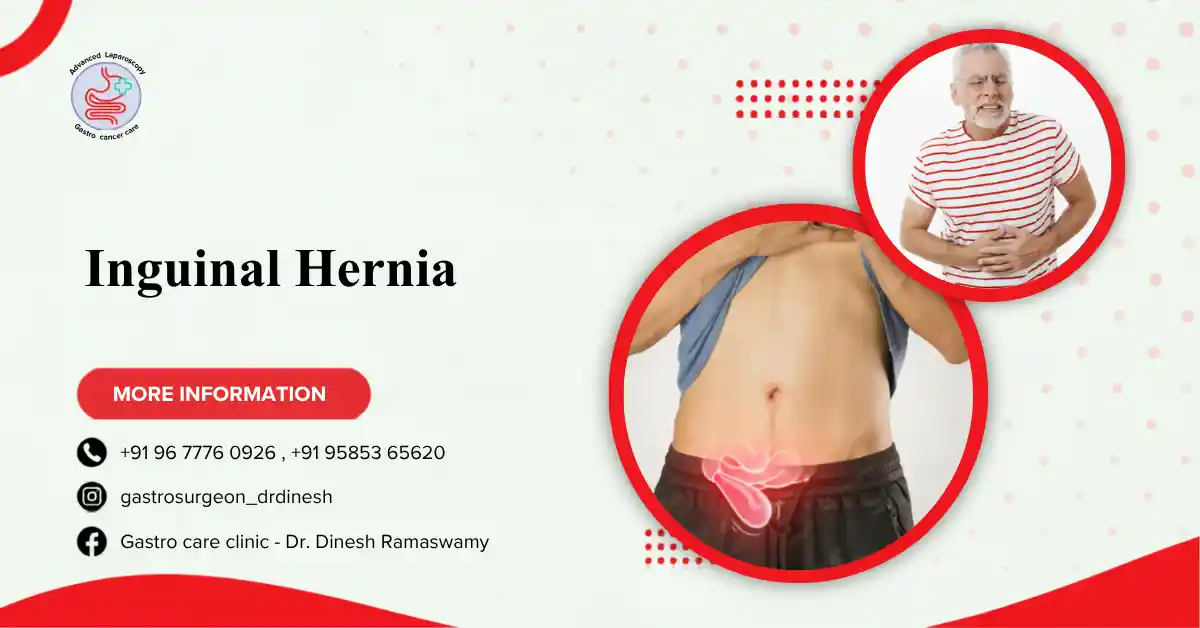 Inguinal Hernia