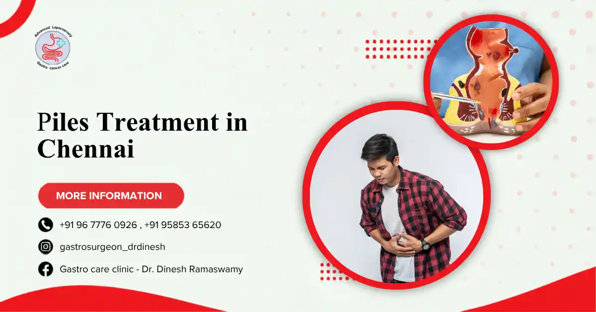 Piles treatment in chennai