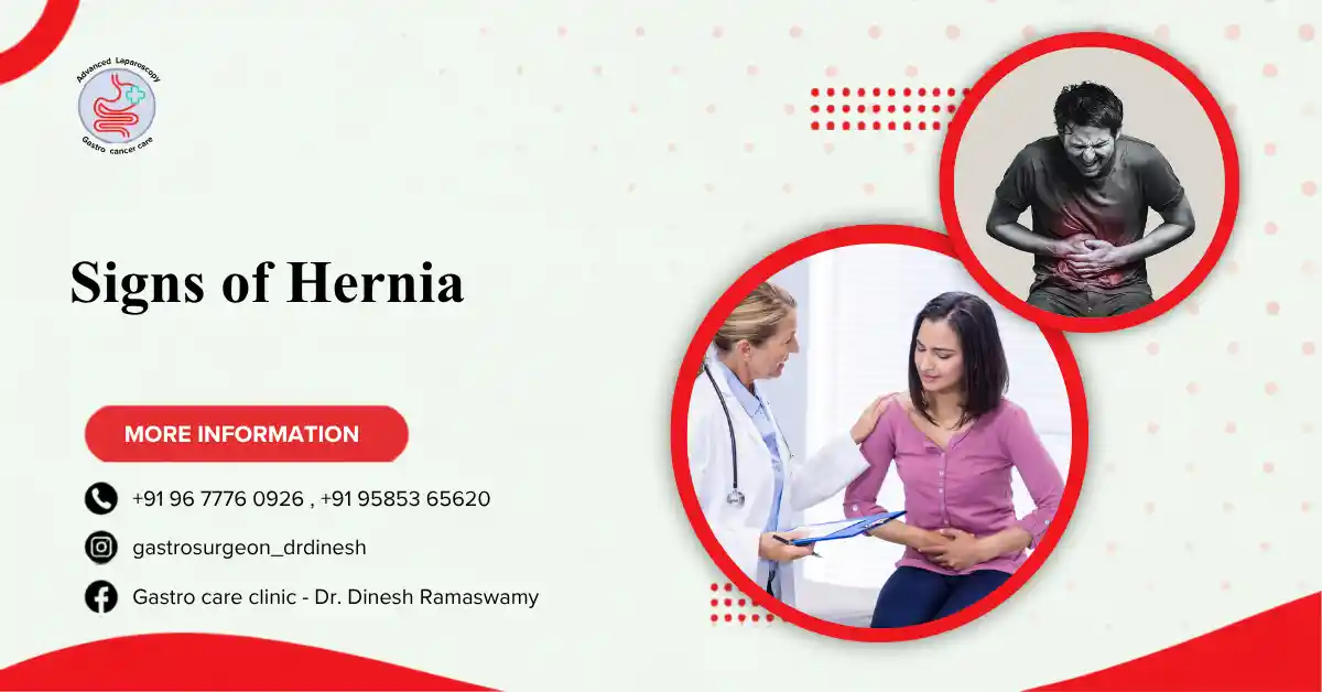 Signs of Hernia