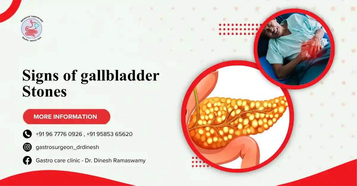 Signs of gallbladder stones