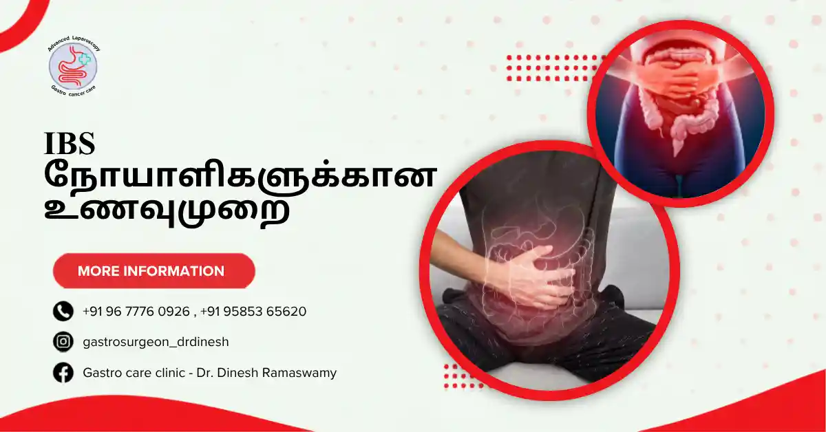 IBS நோயாளிகளுக்கான உணவுமுறை